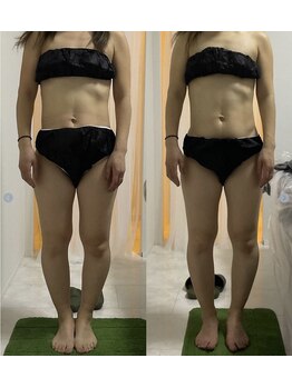 ウル(Ulu)/腸もみビフォーアフター