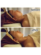 筋線美術コルギ 目黒店/顔、身体も定着ケア