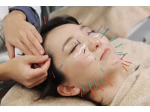 フィーマリー 代官山店(femally)/【美容鍼灸】