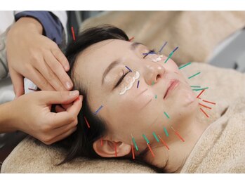 フィーマリー 代官山店(femally)/【美容鍼灸】