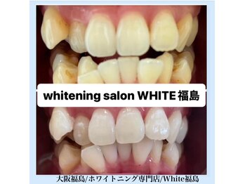 ホワイトニングサロン ホワイト(WHITE)/セルフホワイトニング/大阪/福島