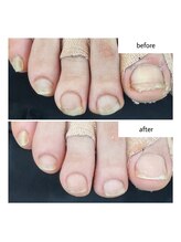 ネイルアトリエ ボン(nail atelier bon)/フットネイルケア