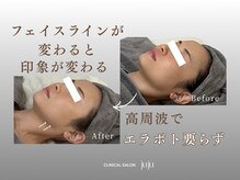 ジュジュ(juju)の雰囲気（高周波で異物に頼らない小顔ケア。）