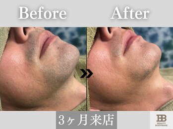 ビューティーアンドボディメイクBB シャオ西尾店/3ヶ月で効果を実感◎