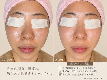 グレイスヒーリング(GRACE HEALING)の写真