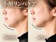 VS28スキンケアスタジオ バリイン 横浜(BALI IN)の写真