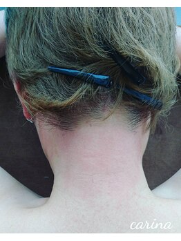 ブラジリアンワックスサロンカリーナ(Carina)/うなじのワックス脱毛