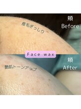 ルーム(room)/フェイスワックスで、産毛撃退