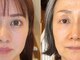 サロン ド ボーテ シャルル(Chaleureux)の写真/各種ピーリングをパーソナルにセレクトします★【改善×理想の肌】を目指し、お好みの素肌を作り上げます＊