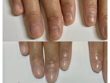 キラネイル アンド アイラッシュ by World Beauty(KIRA)/自爪育成