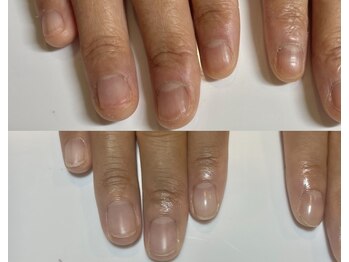 キラネイル アンド アイラッシュ by World Beauty(KIRA)/自爪育成