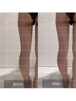 ニカ(Nica)/【下半身カッピング】