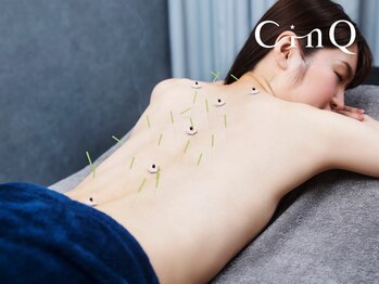 シンク(CINQ)/全身の鍼灸調整もお任せください