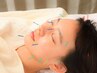 【数量限定ホームケア生プラセンタパックプレゼント】◇美容鍼　国産鍼30本～