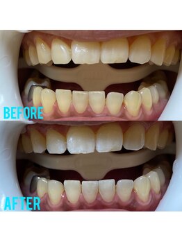 ホワイトニングセンター うるま江洲店/沖縄市・うるま市ホワイトニング