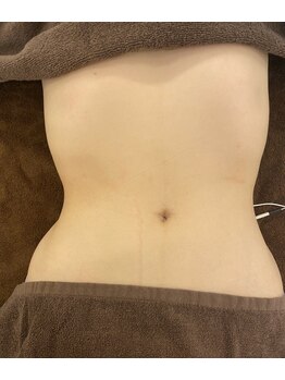 ルメール(Lemaile)/くびれを作ってメリハリボディ♪