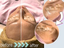 マルサンカクシカク(○△□)/