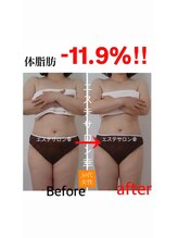 エステサロン 幸/50代　体脂肪　-11.9%
