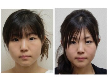 フィシスの写真/鏡や写真を見たら顔が歪んでいた！？と感じている方へ！
本来のあなたが持っている綺麗に整った顔に！