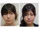フィシスの写真/鏡や写真を見たら顔が歪んでいた！？と感じている方へ！
本来のあなたが持っている綺麗に整った顔に！