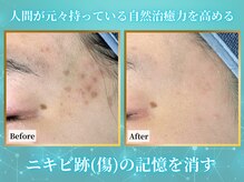 リメイクビューティークリニック(REMAKE BEAUTY CLINIC)の雰囲気(すべての肌悩み(毛穴・ニキビ・シミ・乾燥・シワなど)を改善!)