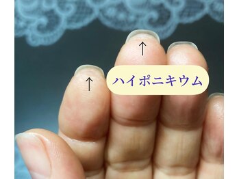 桃の木 吉祥寺店/指の隙間の皮が糊の役割