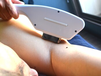 ノーブル(NOBLE)/全身脱毛（ワキ）　施術（３）