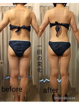 リープ(Lieb)/ボディラジオ波リンパマッサージ