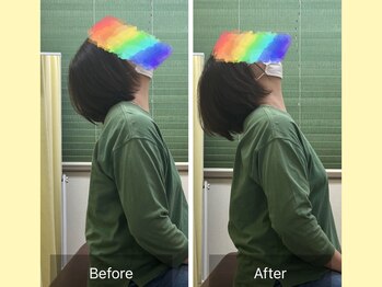 ナオル整体 春日部院(NAORU整体)/あなたの首の動きはどれくらい?