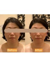 アジール 長岡リバーサイド千秋店(agir)/Before/After画像