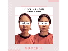 薬手名家 心斎橋店の雰囲気（「コルギ効果」ベビーフェイスケアの施術を10回受けた結果！）