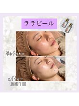 アンドナップ(nap)/乾燥肌、敏感肌でも大丈夫♪