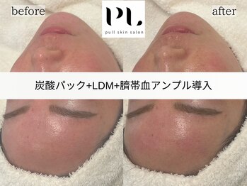 プルスキンサロン 大阪店(pull skin salon)/
