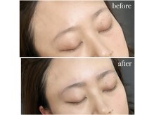 ブリエ(Briller)/ハリウッドブロウリフト