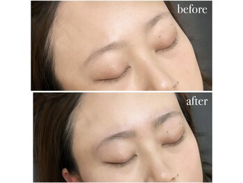 ブリエ(Briller)/ハリウッドブロウリフト