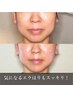 【顔・体の歪みバランスケア◆130分】 骨格調整＋非対称顔コルギ30000→20000