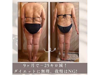 ルモナ(Rumona)の写真