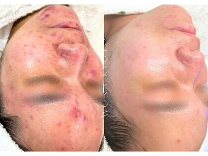 ウォナ(WONA)の写真