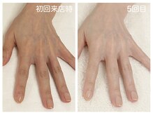 キレイテ 上野店/50代/5回目【ハンドケア稲荷町】