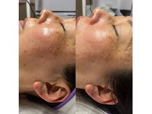リープ 桑名(lieb)の雰囲気（オイルリンパ他、フェイシャルワックス、小顔ケア、毛穴ケアも有）