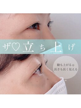 ナナ(NANA)/パーマまつ毛が長くなる？