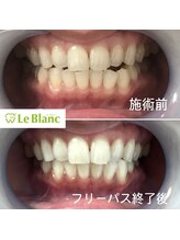 ルブラン 奈良店(Le Blanc)/お疲れ様でした＾＾