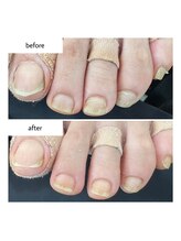 ネイルアトリエ ボン(nail atelier bon)/フットネイルケア