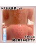 【長年の黒ずみ毛穴対策】毛穴レスフェイシャル  ¥8,800