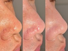 ルーナジェーナ(Luna llena)/池袋/目白/雑司ヶ谷/エステ