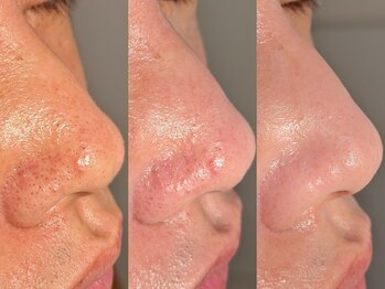 ルーナジェーナ(Luna llena)/池袋/目白/雑司ヶ谷/エステ