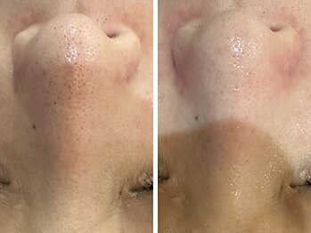 ケアナ 梅田店(CareNa)/メンズの清潔感ここにあり