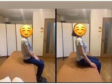 ヴィバランス(Vebalance)の雰囲気（猫背・骨盤矯正　左ビフォー　右アフター）