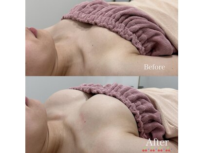 ビューティーサロン シンデレラ 心斎橋本店(Cinderella)の写真