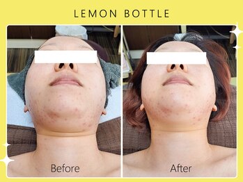 シロカネ 光の森店(SHIROKANE)/レモンボトル☆